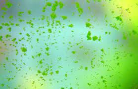 Safe for use in planted aquariums unlike most products treats glass, filters, décor everything will be squeaky clean 16 9 Green Spot Algae
