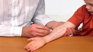 Image result for Skin Testing