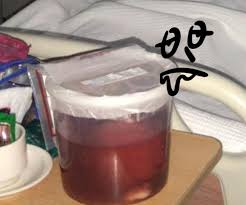 Haid atau yang dalam dunia medis dikenal dengan istilah menstruasi merupakan suatu periode pubertas yang terjadi dan dialami oleh perempuan ketika sudah memasuki usia remaja atau menginjak remaja. Muka Pucat Darah Haid Keluar Banyak Berketul Rupanya Ada Fibroid Sebesar Janin 4 Bulan Mingguan Wanita