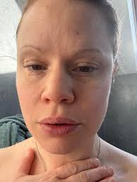 Happy Wednesday 😀. Got renal appointment and tissue typing apt today .  Fingers crossed ! It's very easy to blame every tiny body change