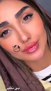 فیلر لب تکنیک M 💉👄, #فیلر #فیلرلب_روسی #بوتاکس_صورت #مادلینگ_صورت #لب