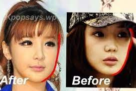 The surgeons' work is easy to find on park bom's today appearance. Park Bom Plastic Surgery Elly Frey