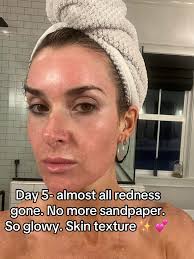 How Long Does It Take to Cover from Co2 Laser