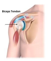 The biceps brachii muscle (biceps) is a large, thick muscle of the arm consisting of two heads. Does Your Shoulder Click Pop Catch Or Snap Orlando Shoulder