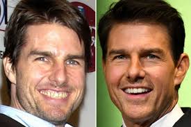 Jurgen klopp has been all smiles with liverpool in the champions league final. As Simon Cowell Shows Off Gleaming Teeth Other Celebs Who Ve Transformed Their Smile Mirror Online