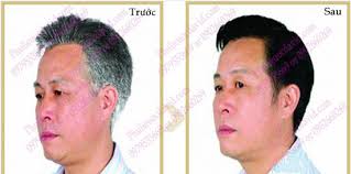 Dầu gội đen tóc YiCAOTEN