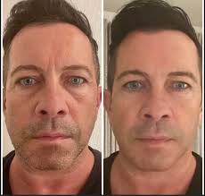 Tropic Skincare Alison Brook