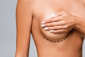 Is Breast Reduction Surgery Right For Me? - Macleod Trail Plastic Surgery  In Calgary