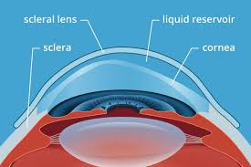 Image result for Sclera