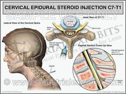 Pin On Stock Medical Illustrations