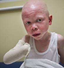 Lance Harms's Instagram, Twitter & Facebook