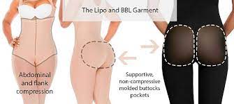 Jan 17, 2013 · your overall contour of the midsection should be long lasting. Bbl Recovery Brazilian Butt Lift Recovery Guide 2021