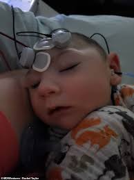 Mother of baby boy born with a tiny head reveals doctors thought her labour  was to blame