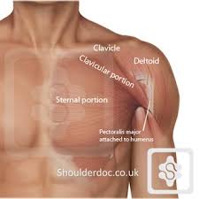 Injuries to the pectoralis major can occur during weightlifting, as well as other bodybuilding exercises that place excessive strain on the shoulders and chest. Pectoralis Major Rupture Shoulderdoc