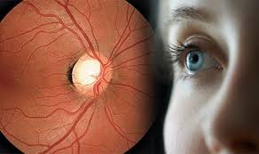 Glaucoma is a disease that damages your eye's optic nerve. Glaucoma Symptoms Redness In The White Of The Eye Could Mean You Re At Risk Express Co Uk