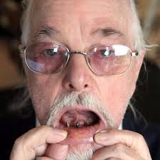 Dentures nightmare goes