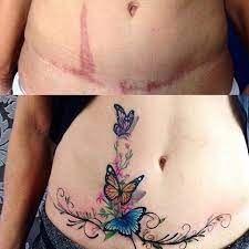 Es un diseño realmente grande para la barriga, en mi opinión. Tattoo Cicatrice Tatuaje Para Cubrir Cicatriz Tatuaje Para Tapar Cicatriz Tatuaje En Cicatriz