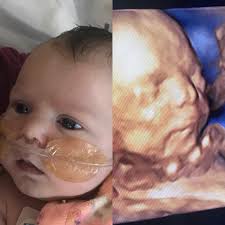 What is a fetal echo?