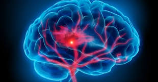 Image result for Tenecteplase