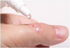 In fact, no antiseptic should be used to treat wounds. Debunking Myths Of Wound Care Advanced Tissue