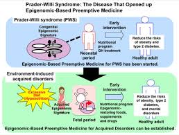 Diseases Free Full Text Prader Willi Syndrome The Disease That Opened Up Epigenomic Based Preemptive Medicine Html