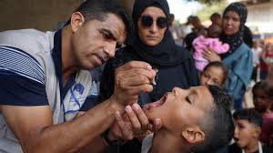 Image result for Polio