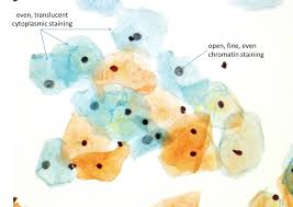 Laboratuvarda Sitoloji Orneklerinin Islenmesi Eurocytology