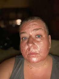 {misc} tonight's mask is also a Florence by mills peel off...low key  calming...since the start of shelter in a place I've turned to skin  care...it is 100% therapeutic...and it's rose gold : r/30PlusSkinCare