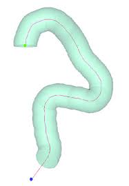 Innovative Methods For Aortic Aneurysm Device Testing Materialise Innovators You Can Count On Medicines and surgery are the two main treatments for aneurysms.