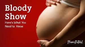 That same day i saw the midwife; Bloody Show Here S What You Need To Know Mama Natural