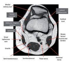 This mri knee cross sectional anatomy tool is absolutely free to use. Knee Springerlink