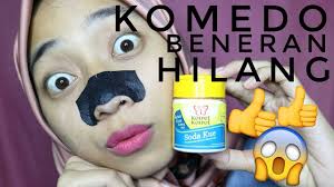 Cara Ampuh Penghilang Komedo Pore Pack Baking Soda Youtube