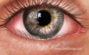 Image result for Entropion