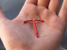An older version was called the birth control implant (aka nexplanon) is a tiny, thin rod about the size of a matchstick. Iud Insertions Increased After Trump S Election Study Says