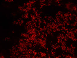 (2) din legea 13412010 privind codul de procedura civild, intdmpinarea trebuie sd d) dovezile cu care se apiri tmpotriva fiecirui capit din cerere, dispozi[iile art. Whole Cell Biocatalysts Essential Workers From Nature To The Industry Carvalho 2017 Microbial Biotechnology Wiley Online Library