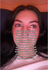 Ehlers Danlos Syndrome Neck Brace