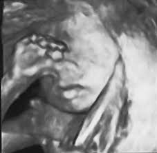 Erlaubt ist ab 2021 nur noch ultraschall zu diagnostischen. 24 Ssw Schwangerschaftswoche Carlas Tagebuch