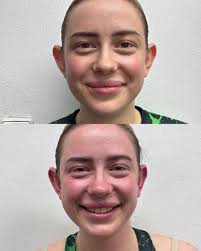 Magicalowa przed i po walce