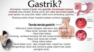 Itulah mengapa, penting untuk mengetahui apa saja tanda sakit ginjal tersebut. Anda Ada Gastrik Atau Pedih Ulu Hati Gout