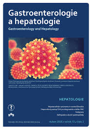 Check spelling or type a new query. Pdf Hepatocellular Carcinoma In Central Slovakia Tertiary Referral Centre Experience With 207 Patients