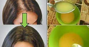 Hizli Sac Uzatan Ve Saclari Gurlestiren Dogal Formul Bitkilog Hair Remedies Hair Loss Remedies Grow Hair