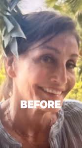 Golden Bachelor's Kathy Swarts Debuts Plastic Surgery Results: Before and  After Photos