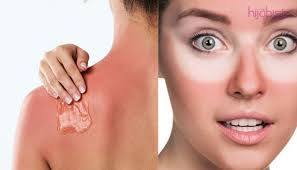 Kisar sehinngg halus, tampalkan dimuka selama 30 minit dan cuci sehingga bersih. Pakar Ini Mencadangkan 13 Cara Menghilangkan Kesan Sunburn Salah Satunya Menggunakan Clorox Hijabista