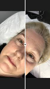 Created by Jade MacKay @TaylorMade Tain , 💖💖Gorgeous Combination brows  for this lovely! BROWS LOOK dark and strong but they will shrink, soften  and fade to a beautiful soft brow colour when healed 👌. ...