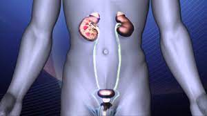 Nierensteine Hirslanden Telezuri Gesundheitssendung Checkup Youtube