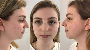 Jun 30, 2021 · the minimum commitment is $19.95/mo + $4.95 shipping and handling and tax when applicable. Curology Review Is The Personalized Skincare Brand Worth It Reviewed