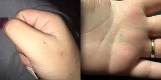 They're also designed with a. Pencil Stabbing Tattoo Marks Go Viral On Twitter