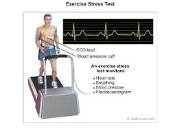 Exercise Stress Test Cardiac Health