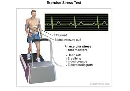 exercise stress test cardiac health