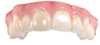 Once the swelling subsides and the gums shrink, this appearance. Natural Looking Cosmetic Dentures False Teeth Problems And Solutions